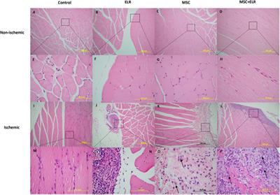 Mesenchymal Stromal Cells Combined With <mark class="highlighted">Elastin-Like</mark> Recombinamers Increase Angiogenesis In Vivo After Hindlimb Ischemia